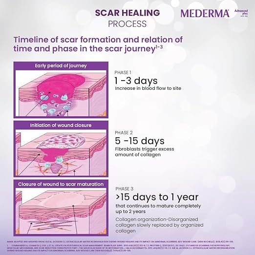 ژل مدرما (Mederma Advanced Plus – رنگ بنفش) ۱۰ گرم – فرمول سه‌گانه با عصاره پیاز (Cepalin®) برای کاهش مشهود جای زخم