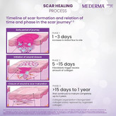 ژل مدرما (Mederma Advanced Plus – رنگ بنفش) ۱۰ گرم – فرمول سهگانه با عصاره پیاز (Cepalin®) برای کاهش مشهود جای زخم