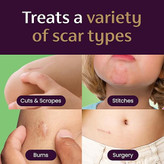 ژل مخصوص کودکان Mederma (بنفش دوستداشتنی) – کاهش مشهود جای زخم با فرمول سهگانهای ایمن برای پوست کودک