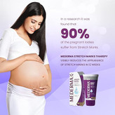 کرم درمان ترک پوست Mederma Stretch Marks Therapy – فرمول گیاهی سهگانه برای بهبود و پیشگیری ترکهای ناشی از بارداری، وزن یا رشد سریع
