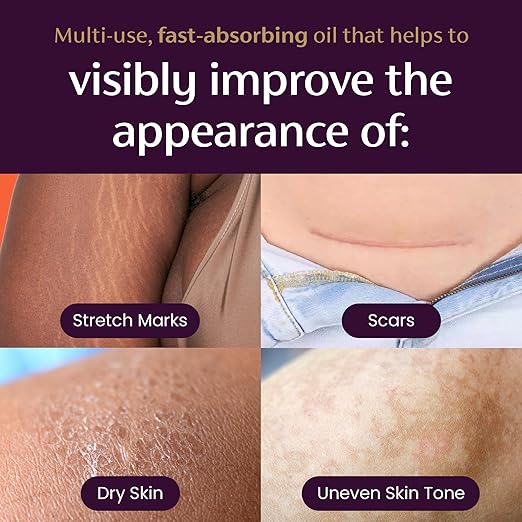 وغن سریع‌جذب Mederma Quick Dry Oil – ترکیب گیاهی بی‌چرب برای ترمیم جای زخم و ترک‌های پوستی