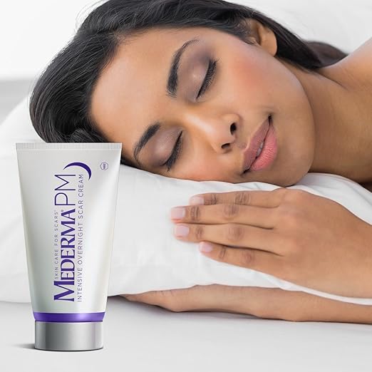 کرم درمان جای زخم مدرما با SPF 30 (Mederma Scar Cream + SPF 30) – کرم مرطوب‌کننده و محافظ در برابر آفتاب برای کاهش ظاهر انواع اسکار (زخم‌های جراحی، جوش، سوختگی)